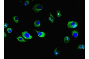 Immunofluorescent analysis of MCF-7 cells using ABIN7151390 at dilution of 1:100 and Alexa Fluor 488-congugated AffiniPure Goat Anti-Rabbit IgG(H+L) (ENPP6 抗体  (AA 31-330))
