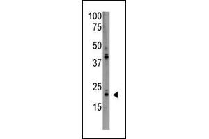 The anti-PD Antibody (C-term) (ABIN390190 and ABIN2840681) is used in Western blot to detect PD in HL60 lysate. (PDAP1 抗体  (C-Term))