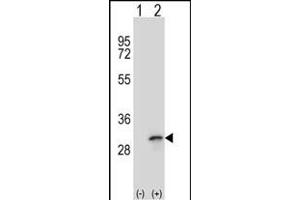 Western blot analysis of FHL1 (arrow) using rabbit polyclonal FHL1 Antibody (C-term) (ABIN390835 and ABIN2841061).