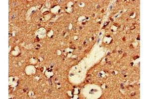 Immunohistochemistry of paraffin-embedded human brain tissue using ABIN7161314 at dilution of 1:100 (Neuroligin 1 抗体  (AA 51-300))