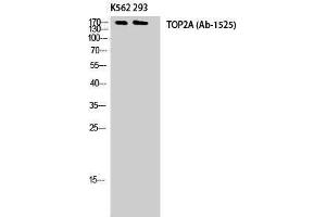 Western Blotting (WB) image for anti-Topo IIalpha (Tyr174) antibody (ABIN3177762) (Topo IIalpha (Tyr174) 抗体)