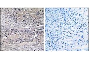 Immunohistochemistry analysis of paraffin-embedded human thyroid gland tissue, using IREB1 (Ab-711) Antibody. (Aconitase 1 抗体  (AA 681-730))