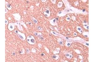 Detection of STX1A in Human Cerebrum Tissue using Polyclonal Antibody to Syntaxin 1A, Brain (STX1A) (STX1A 抗体  (AA 1-255))
