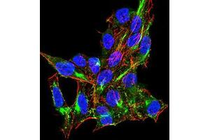 Immunocytochemistry (ICC) image for anti-DEAD (Asp-Glu-Ala-Asp) Box Polypeptide 58 (DDX58) (AA 789-925) antibody (ABIN5542511)