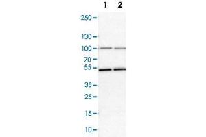 Western Blot analysis of Lane 1: NIH-3T3 cell lysate (mouse embryonic fibroblast cells) and Lane 2: NBT-II cell lysate (Wistar rat bladder tumor cells) with MCM7 polyclonal antibody . (MCM7 抗体)