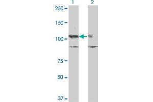 Western Blot analysis of KIT expression in transfected 293T cell line by KIT monoclonal antibody (M10), clone x1. (KIT 抗体  (AA 41-140))