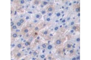 Immunohistochemistry (IHC) image for anti-serpin Peptidase Inhibitor, Clade A (Alpha-1 Antiproteinase, Antitrypsin), Member 12 (SERPINA12) (AA 52-143) antibody (ABIN1173456)
