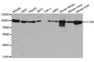 Western blot analysis of extracts of various cell lines, using CLCN5 antibody. (Chloride Channel 5 抗体  (AA 637-816))