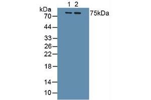 Figure. (IL1R1 抗体  (AA 120-208))
