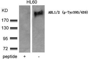 ABL1/2 抗体  (pTyr393, pTyr439)