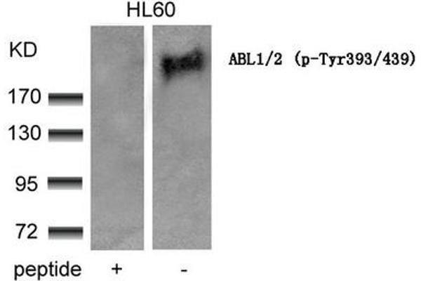 ABL1/2 抗体  (pTyr393, pTyr439)
