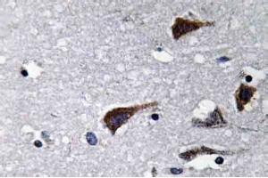 Immunohistochemistry analysis of Cathepsin B Antibody in Paraffin-Embedded Human brain tissue. (Cathepsin B 抗体)