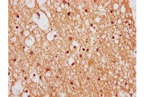 IHC image of ABIN7176211 diluted at 1:400 and staining in paraffin-embedded human brain tissue performed on a Leica BondTM system. (ZNF282 抗体  (AA 240-384))