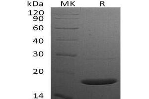 Western Blotting (WB) image for Synuclein, alpha (SNCA) protein (His tag) (ABIN7320687) (SNCA Protein (His tag))