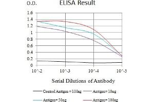 Black line: Control Antigen (100 ng),Purple line: Antigen (10 ng), Blue line: Antigen (50 ng), Red line:Antigen (100 ng) (CD72 抗体  (AA 117-359))