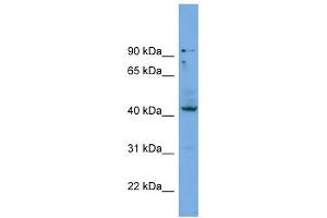 WB Suggested Anti-HOXB3 Antibody Titration: 0. (HOXB3 抗体  (Middle Region))