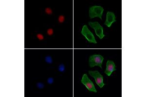ABIN6263144 and ABIN6277139 staining Hela cells by IF/ICC.
