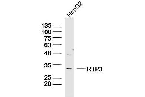 Human HepG2 lysates probed with RTP3 Polyclonal Antibody, Unconjugated  at 1:300 dilution and 4˚C overnight incubation. (RTP3 抗体  (AA 21-120))
