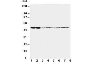 Western blot testing of 5HT2A Receptor antibody and Lane 1:  rat brain;  2: rat brain;  3: mouse brain;  4: mouse brain and human samples  5: U87;  6: SMMC-7721;  7: HT1080;  8: COLO320 (HTR2A 抗体  (C-Term))