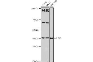 Western blot analysis of extracts of various cell lines, using NEIL1 antibody (ABIN6130579, ABIN6144514, ABIN6144515 and ABIN6221523) at 1:1000 dilution. (NEIL1 抗体  (AA 187-476))