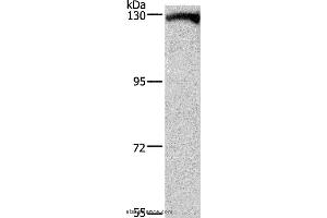 Western blot analysis of Human testis tissue, using DAAM1 Polyclonal Antibody at dilution of 1:400 (DAAM1 抗体)