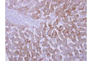 IHC-P Image FMO3 antibody [N2C2], Internal detects FMO3 protein at cytosol on human normal liver by immunohistochemical analysis. (FMO3 抗体)