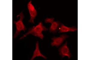 ABIN6274599 staining HeLa by IF/ICC. (CDH18 抗体  (N-Term))