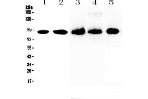 Western blot analysis of CD44 using anti-CD44 antibody . (CD44 抗体  (AA 21-259))
