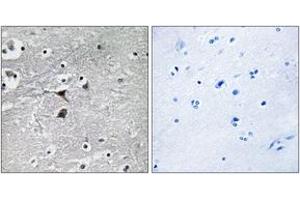 Immunohistochemistry analysis of paraffin-embedded human brain tissue, using Tryptophan Hydroxylase (Ab-260) Antibody. (Tryptophan Hydroxylase 1 抗体  (AA 231-280))