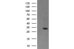 Image no. 1 for anti-Retinoic Acid Receptor Responder (Tazarotene Induced) 1 (RARRES1) antibody (ABIN1500603)