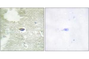 Immunohistochemistry analysis of paraffin-embedded human brain, using TGF beta Receptor II (Phospho-Ser225/250) Antibody. (TGFBR2 抗体  (pSer225))