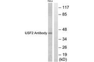 Western blot analysis of extracts from HeLa cells, using USF2 Antibody. (USF2 抗体  (AA 196-245))