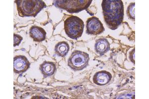 Paraformaldehyde-fixed, paraffin embedded mouse skin, Antigen retrieval by boiling in sodium citrate buffer (pH6) for 15min, Block endogenous peroxidase by 3% hydrogen peroxide for 30 minutes, Blocking buffer at 37°C for 20min, Antibody incubation with Cytochrome C (1F10) Monoclonal Antibody  at 1:50 overnight at 4°C, followed by a conjugated secondary and DAB staining. (Cytochrome C 抗体)