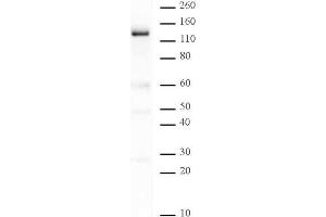 PARP-1 N-terminal antibody tested by Western blot. (PARP1 抗体  (N-Term))
