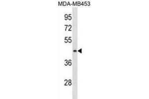Western Blotting (WB) image for anti-Asparagine-Linked Glycosylation 8, alpha-1,3-Glucosyltransferase Homolog (ALG8) antibody (ABIN3000312) (ALG8 抗体)