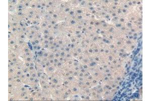 IHC-P analysis of Human Liver Tissue, with DAB staining. (Retinol Binding Protein 5 抗体  (AA 2-135))