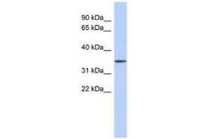 Image no. 1 for anti-F-Box Protein 31 (FBXO31) (AA 431-480) antibody (ABIN6743760) (FBXO31 抗体  (AA 431-480))