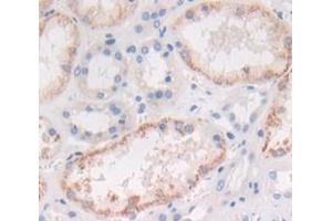 IHC-P analysis of Human Tissue, with DAB staining. (IL1A 抗体  (AA 113-271))