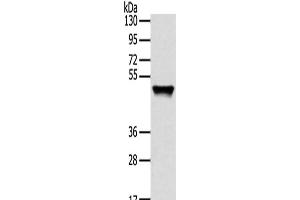 Western Blot analysis of Human fetal liver tissue using TRIM14 Polyclonal Antibody at dilution of 1/800 (TRIM14 抗体)