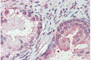 Anti-SLC44A2 antibody  ABIN960812 IHC staining of human prostate. (SLC44A2 抗体  (Internal Region))