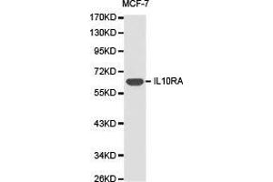 Western Blotting (WB) image for anti-Interleukin 10 Receptor, alpha (IL10RA) antibody (ABIN1873185) (IL-10RA 抗体)