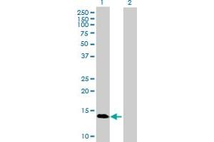 Western Blot analysis of GBA3 expression in transfected 293T cell line by GBA3 MaxPab polyclonal antibody. (GBA3 抗体  (AA 1-162))