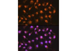 Immunofluorescence analysis of HeLa cells using PER2 Rabbit mAb (ABIN7269224) at dilution of 1:100 (40x lens). (PER2 抗体)