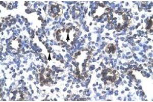 Immunohistochemical staining (Formalin-fixed paraffin-embedded sections) of human lung with FOXA3 polyclonal antibody  at 4-8 ug/mL working concentration. (FOXA3 抗体  (Internal Region))