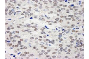 Immunohistochemistry (IHC) image for anti-Lysine (K)-Specific Demethylase 1A (KDM1A) (AA 50-100) antibody (ABIN7448433)