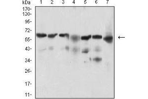 Western blot analysis using BACE1 mouse mAb against Hela (1), SK-N-SH (2), HepG2 (3), C6 (4), PC-12 (5), PANC-1 (6), NIH/3T3 (7) cell lysate. (BACE1 抗体  (AA 112-324))