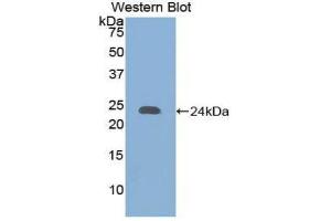 Western Blotting (WB) image for anti-Collagen, Type XVIII (COL18) (AA 1572-1754) antibody (ABIN1858449) (COL18 抗体  (AA 1572-1754))