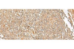 Immunohistochemistry of paraffin-embedded Human tonsil tissue using FGL2 Polyclonal Antibody at dilution of 1:45(x200) (FGL2 抗体)