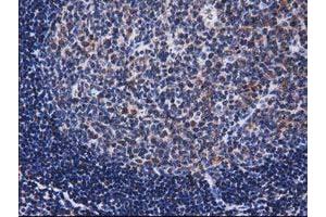 Image no. 14 for anti-Nonhomologous End-Joining Factor 1 (NHEJ1) antibody (ABIN1499728)