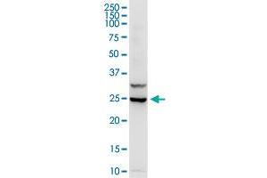 IL3 MaxPab rabbit polyclonal antibody. (IL-3 抗体  (AA 1-152))